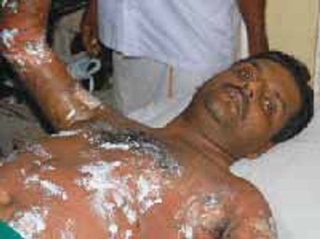 ರೈತ ಮುಖಂಡನ ಸಾವಿಗೆ ಬೆಲೆಯೇ ಇಲ್ಲ