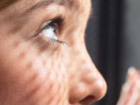 ಅಂಧರಿಗೆ ಬೆಳಕಾಗಬಲ್ಲ 'ಸ್ಟೆಮ್ ಸೆಲ್' ಥೆರಪಿ