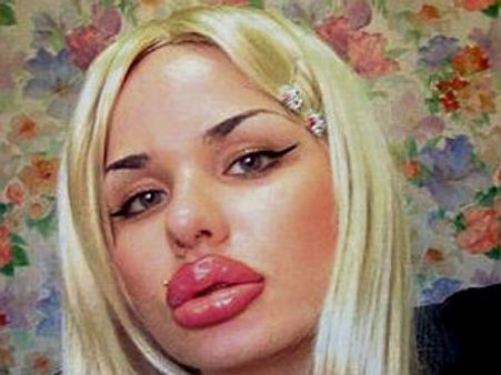 ಈ ಯುವತಿಯ ತುಟಿಗಳು ವಿಶ್ವದಲ್ಲೇ ಅತಿ ದೊಡ್ಡವು!