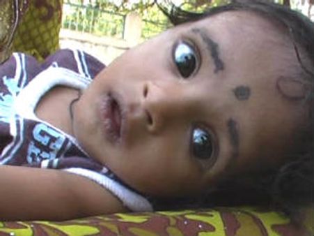 ಹಸುಗೂಸಿಗೆ ಹೃದ್ರೋಗ, ಚಾಚಿಬಂದ ಸಹಾಯಹಸ್ತ