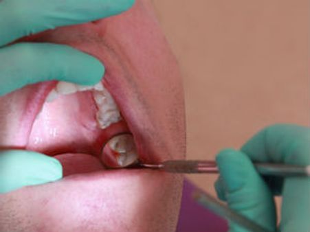 ರೀ ಡೆಂಟಲ್ ಡಾಕ್ಟ್ರೆ, ಸೇಡಿಗೂ ಒಂದು ಮಿತಿ ಬೇಡ್ವಾ?