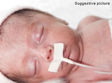 ಚೆನ್ನೈನಲ್ಲಿ ಅಗ್ನಿ ಶಿಶು, ವೈದ್ಯ ಲೋಕದ ಅಚ್ಚರಿ!