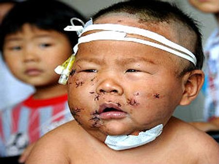 ಕಂದ ಮೊಲೆ ಕಚ್ಚಿದ ಅಂತ ತಾಯಿ 90 ಬಾರಿ ಇರಿದಳು!