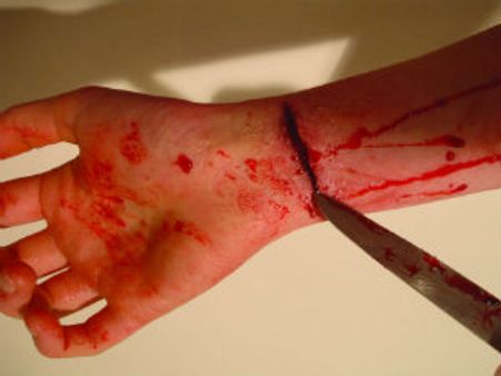 Ragging: ಯುವತಿ ಬಲಿ; ಸಹೋದ್ಯೋಗಿಗಳ ಸೆರೆ