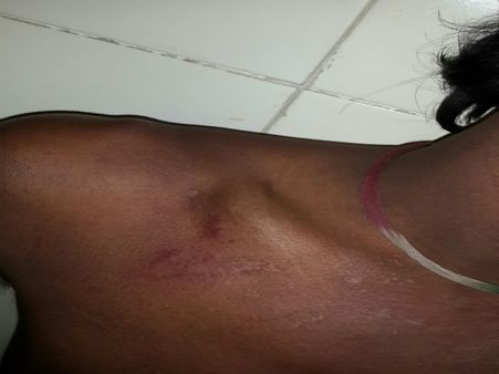 ಗದಗದಲ್ಲಿ ಶ್ರೀರಾಮ ಸೇನೆ ಕಾರ್ಯಕರ್ತರ ಮೇಲೆ ಹಲ್ಲೆ