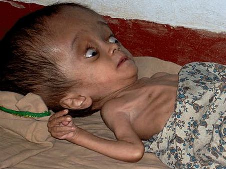 ಎಂಡೋಸಲ್ಫಾನ್ ಸಂತ್ರಸ್ತರು ಸರ್ಕಾರದ ಮುಂದಿಟ್ಟ ಬೇಡಿಕೆಯೇನು?