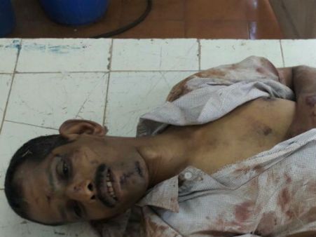 ಸುಳ್ಯ: ಹೋರಿ ಹಾಯ್ದು ದೇವಾಲಯದ ಮ್ಯಾನೇಜರ್ ಸಾವು