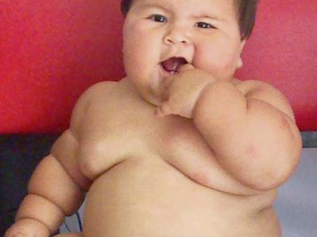 ಬಾಲ್ಯದಲ್ಲಿ ಬೊಜ್ಜಿದ್ದರೆ ಲಕ್ವಾ ಹೊಡೆಯುವ ಸಾಧ್ಯತೆ ಹೆಚ್ಚು: ವರದಿ