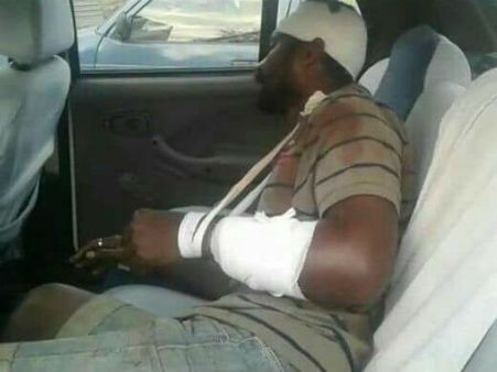 ಕೊಡಗು: ಸಾಲ ಮರುಪಾವತಿಸದ್ದಕ್ಕೆ ನಾಯಿ ಕೈಲಿ ಕಚ್ಚಿಸಿದ ಎಸ್ಟೇಟ್ ಮಾಲಿಕ