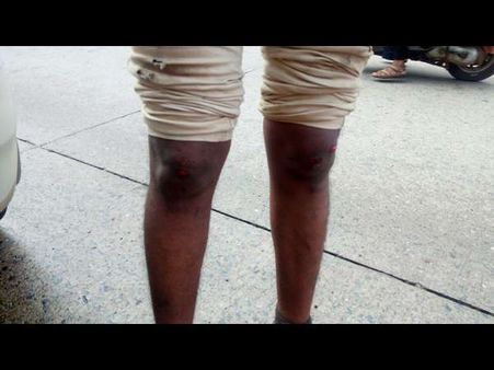 ಮಂಗಳೂರಿನಲ್ಲಿ ರಸ್ತೆಯಲ್ಲಿ ಹರಿದ ಆಯಿಲ್, ಉರುಳಿ ಬಿದ್ದ ಬೈಕ್ ಸವಾರರು