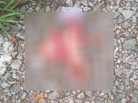 ರಾಮನಗರ ಬಸ್ ನಿಲ್ದಾಣದಲ್ಲಿ ಹೆಣ್ಣು ಭ್ರೂಣ ಪತ್ತೆ