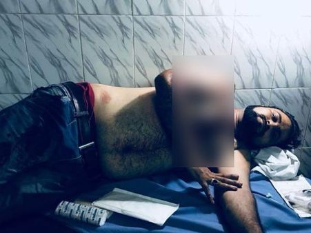 ಉತ್ತರ ಪ್ರದೇಶ: ಡಾ. ಕಫೀಲ್ ಖಾನ್ ಸಹೋದರನ ಮೇಲೆ ಗುಂಡಿನ ದಾಳಿ