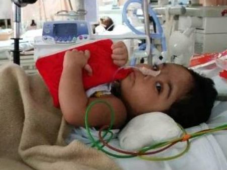 ಸಂತಸದ ಬುಗ್ಗೆಯಂತಿದ್ದ ಮಗುವೀಗ ಆಸ್ಪತ್ರೆಯ ಐಸಿಯುನಲ್ಲಿ