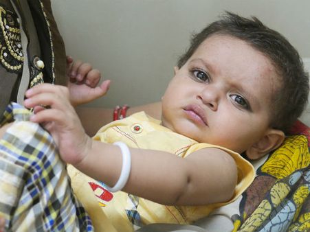 ಗಾರೆ ಕೆಲಸದವನ 1 ವರ್ಷದ ಮಗು ಉಳಿಸಲು ಸಹಾಯ ಮಾಡಿ