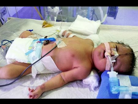 ಒಂದು ನವಜಾತ ಮಗುವಿನ ಪ್ರಾಣ ಉಳಿಸಿದ ಭಾಗ್ಯ ನಿಮ್ಮದಾಗಲಿ