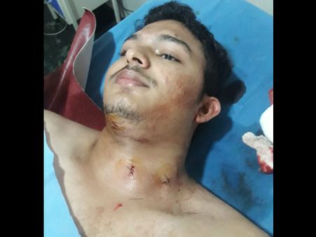 ಬಜ್ಪೆಯಲ್ಲಿ ಯುವಕನಿಗೆ ಚೂರಿ ಇರಿತ:ಸಿಸಿ ಕ್ಯಾಮೆರಾದಲ್ಲಿ ಸೆರೆ ಆಯ್ತು ದುಷ್ಕರ್ಮಿಗಳ ಕೃತ್ಯ