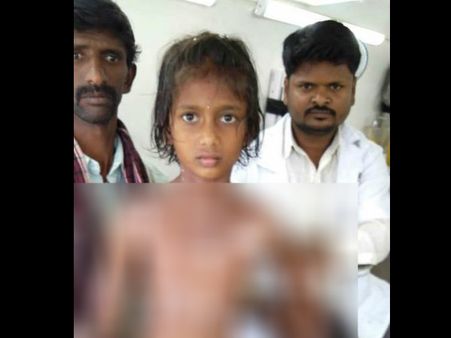 ಸಂಗಾಪುರ ಸರ್ಕಾರಿ ಶಾಲೆಯಲ್ಲಿ ಕುಕ್ಕರ್ ಸ್ಫೋಟ: ವಿದ್ಯಾರ್ಥಿನಿಗೆ ಗಾಯ