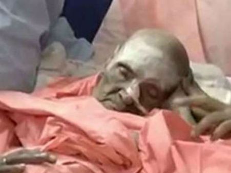 ಶ್ರೀಗಳ ಸ್ಥಿತಿ ಚಿಂತಾಜನಕ, ಆದರೆ ಪ್ರಯತ್ನ ಕೈಬಿಟ್ಟಿಲ್ಲ: ವೈದ್ಯ ಪರಮೇಶ್