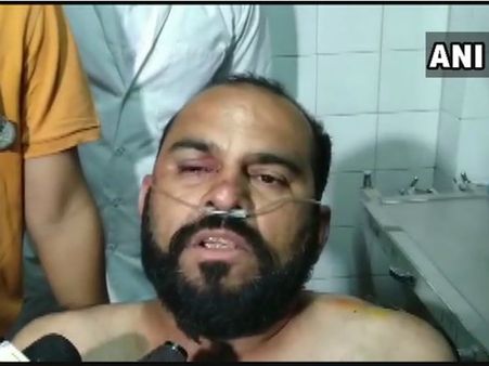 ಹಾರ್ದಿಕ್ ಪಟೇಲ್‌ಗೆ ಕಪಾಳಮೋಕ್ಷ ಮಾಡಲು ಹಿಂದಿದ್ದ ಕಾರಣ ಬಿಚ್ಚಿಟ್ಟ ವ್ಯಕ್ತಿ