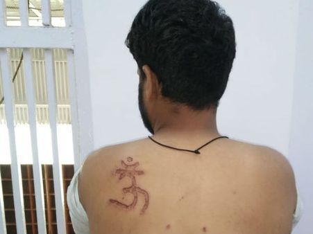 ಅಮಾನವೀಯ: ಮುಸ್ಲಿಂ ಖೈದಿಗೆ ಓಂ ಚಿಹ್ನೆ ಬರೆ ಹಾಕಿದ ಜೈಲು ಅಧಿಕಾರಿ