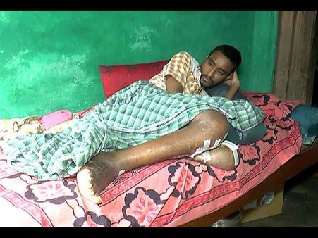 ದಯಾಮರಣ ಪಾಲಿಸಿ ಎಂದು ಕಣ್ಣೀರಿಡುತ್ತಿರುವ ಗುರುವಿನಪುರ ಗ್ರಾಮದ ಯುವಕ