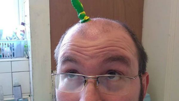 ಹಾಸ್ಯ ಲೇಖನ: ಕ್ವಾಪ ಮಾಡ್ಕೊಂಡಿದೆ ಕೂದ್ಲು ತಲೆಮ್ಯಾಲೆ!