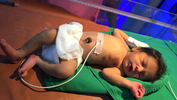 ಹೆಣ್ಣೆಂದು ಪುಟ್ಟ ಕಂದನ ಚೀಲದಲ್ಲಿ ಬಿಟ್ಟು ಹೋದರು