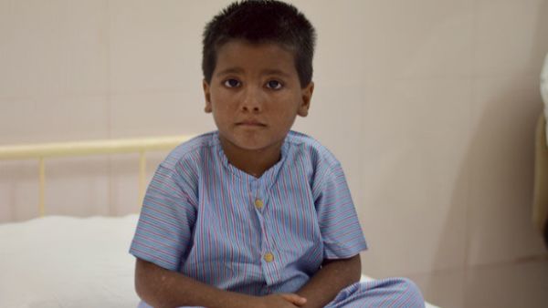 ಅಪರೂಪದ ಕಾಯಿಲೆಗೆ ತುತ್ತಾಗಿರುವ ಈ ಕಂದಮ್ಮನ ಜೀವ ಉಳಿಸಿ