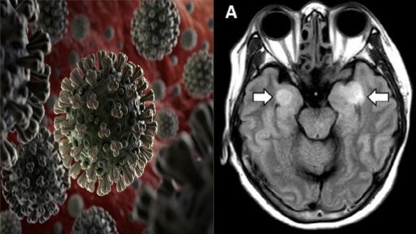 ಕೊರೊನಾ ವೈರಸ್ ಕೊಲ್ಲುವಂತಾ ಬಿಸಿಲು ಬರುತ್ತೆ ಎಚ್ಚರ ಎಚ್ಚರ!