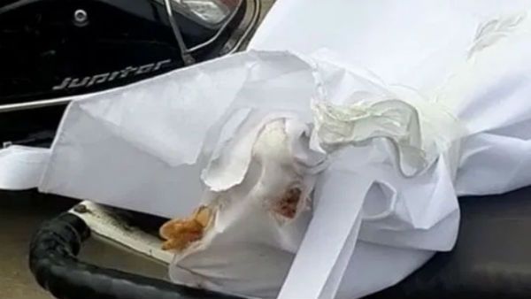 ಆಸ್ಪತ್ರೆಯಲ್ಲಿ ಮೃತ ಕೊವಿಡ್ ರೋಗಿಯ ದೇಹ ಕಚ್ಚಿ ತಿಂದ ಇಲಿಗಳು