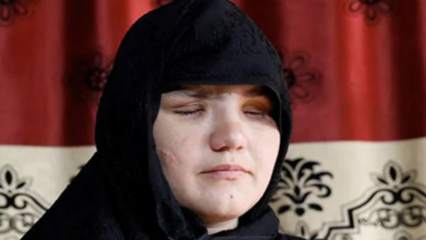 ಅಫ್ಘಾನಿಸ್ತಾನ; ಪೊಲೀಸ್ ಅಧಿಕಾರಿಯಾದ ಮಹಿಳೆ ಕಣ್ಣು ಕಿತ್ತ ದುಷ್ಕರ್ಮಿಗಳು