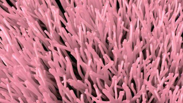 ಕೇರಳ: 6 ಮಂದಿಗೆ ಶಿಗೆಲ್ಲಾ ಸೋಂಕು, ಒಂದು ಬಲಿ