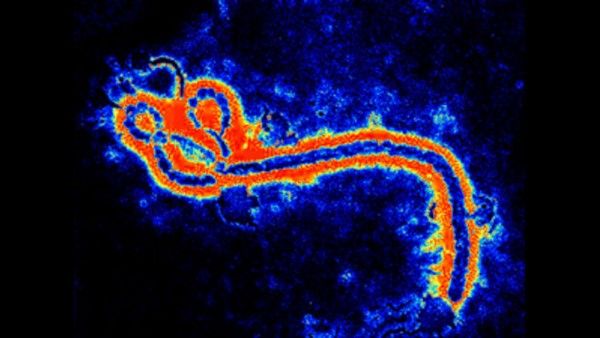 ಏನಿದು 'ಡಿಸೀಸ್ ಎಕ್ಸ್' ಮಾರಕ ಕಾಯಿಲೆ?: ಎಬೋಲಾ ಕಂಡುಹಿಡಿದ ವಿಜ್ಞಾನಿ ನೀಡಿದ ಎಚ್ಚರಿಕೆ