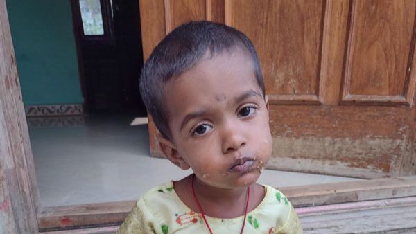 ಈ ಮಗುವಿನ ಅಪರೂಪದ ಆರೋಗ್ಯ ಸಮಸ್ಯೆಗೆ ನಿಮ್ಮ ನೆರವಷ್ಟೇ ಪರಿಹಾರ...