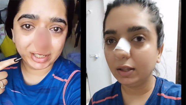 ನಾನು ಬೆಂಗಳೂರು ಬಿಟ್ಟು ಎಲ್ಲೂ ಹೋಗಿಲ್ಲ; ಮತ್ತೆ ಕಾಣಿಸಿಕೊಂಡ ಹಿತೇಶಾ ಚಂದ್ರಾನಿ