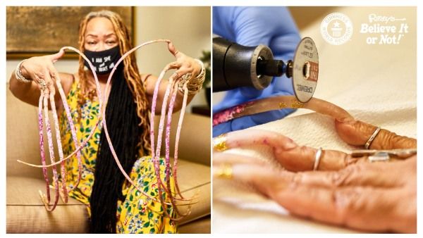 ಬರೋಬ್ಬರಿ 30 ವರ್ಷಗಳ ಬಳಿಕ ಉಗುರು ತೆಗೆದ ಮಹಿಳೆ