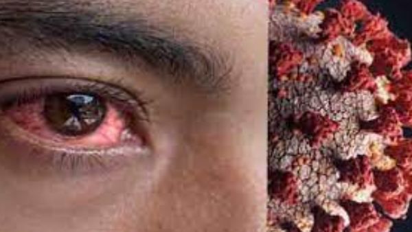 ವಿಕ್ಟೋರಿಯಾ ಆಸ್ಪತ್ರೆಯಲ್ಲಿ ಬ್ಲ್ಯಾಕ್ ಫಂಗಸ್ ಔಷಧಿ ಕಳುವು