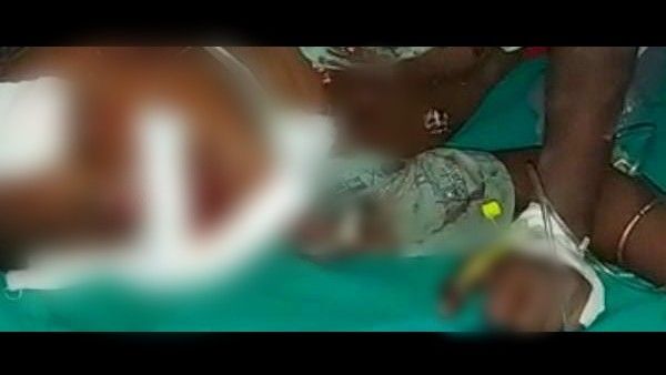 ಹಾವೇರಿ: ಮೊಬೈಲ್ ಬ್ಯಾಟರಿ ಸ್ಫೋಟ ಬಾಲಕನ ಬೆರಳು ಕಟ್!