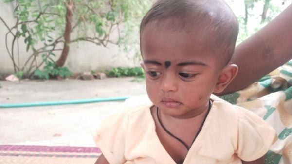 ಈ ಪುಟ್ಟ ಮಗುವಿನ ಶಸ್ತ್ರಚಿಕಿತ್ಸೆಗೆ ನಿಮ್ಮ ಸಹಾಯವಿರಲಿ...