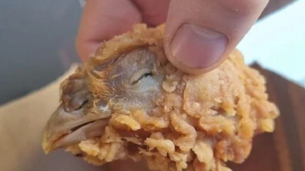 ಕೆಎಫ್‌ಸಿ ಹಾಟ್ ವಿಂಗ್ಸ್ ಬಾಕ್ಸ್‌ನಲ್ಲಿತ್ತು ಕೋಳಿ ತಲೆ: ಮಹಿಳೆ ಶಾಕ್