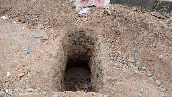 ಕಣ್ಣು ಕಾಣದ ವ್ಯಕ್ತಿ ಕಾಲು ಮುರಿದ ಶಿವಮೊಗ್ಗ ಸ್ಮಾರ್ಟ್ ಸಿಟಿ ಗುಂಡಿ!