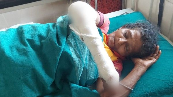 ಜಾಗ ವಿವಾದ; ಪುತ್ತೂರಿನಲ್ಲಿ ಮಹಿಳೆಯ ಮೇಲೆ ಹುಲ್ಲು ಕಟಾವು ಯಂತ್ರದಿಂದ ದಾಳಿ!