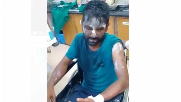 ಶಿವಮೊಗ್ಗ: ಹೊಟ್ಟೆ ತುಂಬಾ ಉಂಡು ಅಡುಗೆ ಭಟ್ಟನ ಮೇಲೆ ಕುದಿಯುವ ಎಣ್ಣೆ ಎರಚಿದ ಪಾಪಿಗಳು