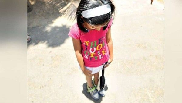 Zero Shadow Day : ನೆರಳೇ ಕಾಣಿಸಲ್ಲ: ಏ. 25 ಶೂನ್ಯ ನೆರಳಿನ ದಿನ- ಆಸಕ್ತಿ ಇದ್ದವರಿಗೆ 2 ದಿನ ವರ್ಕ್‌ಶಾಪ್