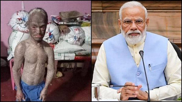 ಮಂಡ್ಯ ವಿಶೇಷ ಚೇತನ ಯುವಕನ ಸಮಸ್ಯೆ 2 ದಿನದಲ್ಲಿ ಪರಿಹರಿಸಿದ ಮೋದಿ