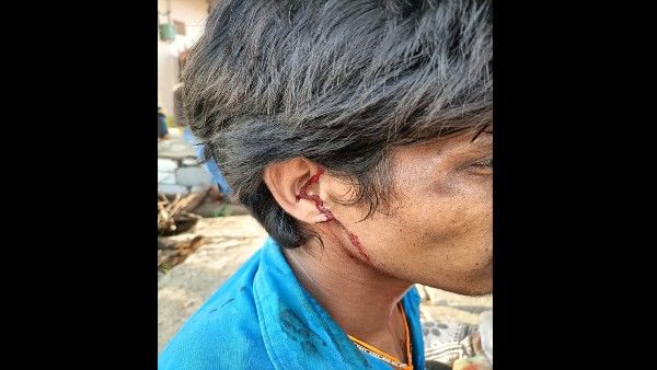 ಅಂತರ್ಜಾತಿ ವಿವಾಹ : ಯುವಕನ ಪೋಷಕರ ಮೇಲೆ ಮಾರಣಾಂತಿಕ ಹಲ್ಲೆ, ಆಸ್ಪತ್ರೆಗೆ ದಾಖಲು