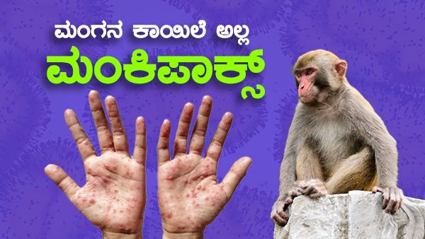ಮಂಗನ ಕಾಯಿಲೆಗೂ ಮಂಕಿಪಾಕ್ಸ್‌ಗೂ ಏನು ವ್ಯತ್ಯಾಸ? ಎರಡೂ ಒಂದೇ ಅಲ್ಲ