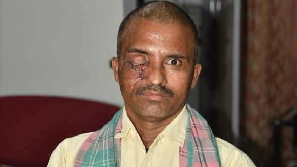 ಕರಡಿ ಕಡಿತದಿಂದ ತೀವ್ರ ಗಾಯಗೊಂಡಿದ್ದ ವ್ಯಕ್ತಿಗೆ ಹುಬ್ಬಳ್ಳಿಯ ಕಿಮ್ಸ್‌ನಲ್ಲಿ ಯಶಸ್ವಿ ಶಸ್ತ್ರಚಿಕಿತ್ಸೆ