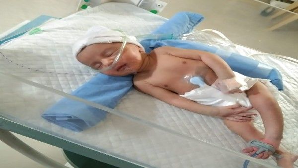 ಹೊಸದುರ್ಗ; ಪುಟ್ಟ ಕಂದಮ್ಮನಿಗೆ ಶ್ವಾಸಕೋಶ ತೊಂದರೆ; ಚಿಕಿತ್ಸೆಗೆ ಹಣವಿಲ್ಲದೆ ಪೋಷಕರು ಕಣ್ಣೀರು