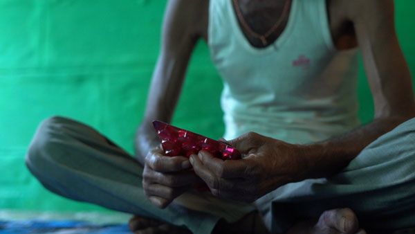 ಟಿಬಿ ಪ್ರಕರಣಗಳು ಹೆಚ್ಚಳ: ಭಾರತದಲ್ಲಿ ಮತ್ತೆ ಟಿಬಿ ಮಾರಣಾಂತಿಕ ಕಾಯಿಲೆಯೇ?